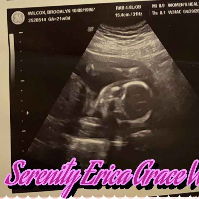 Picture of Brooklyn Wilcox