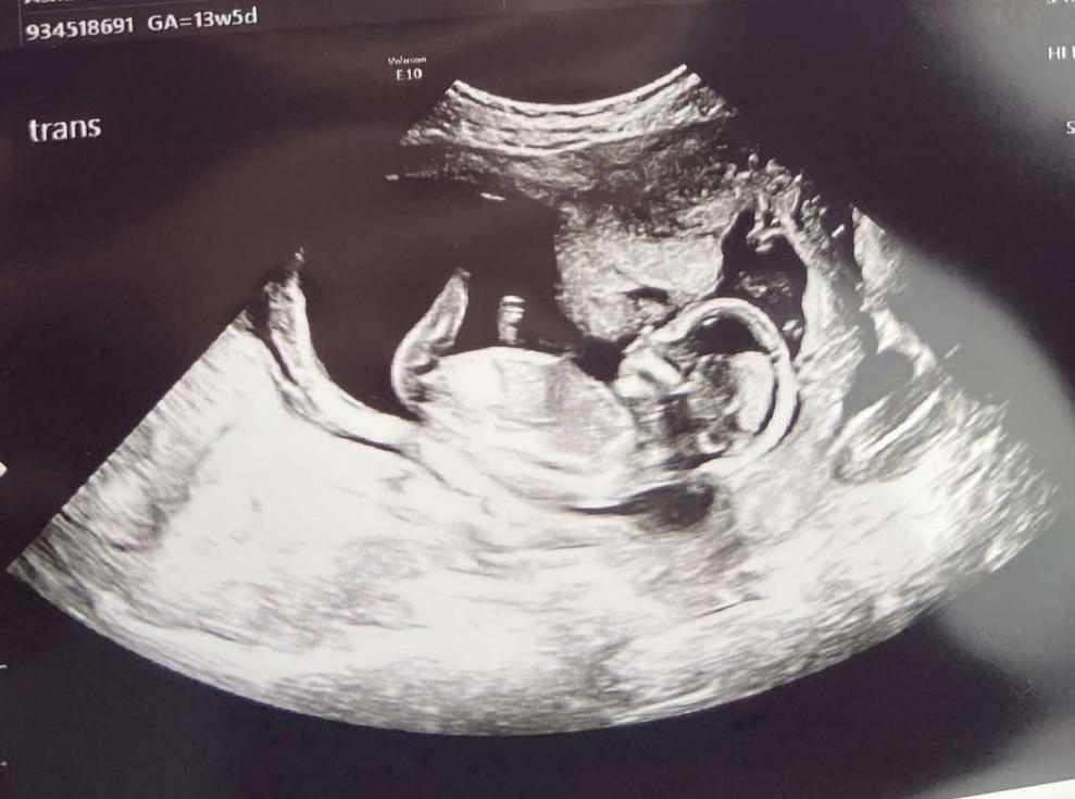 This little one is set to be …