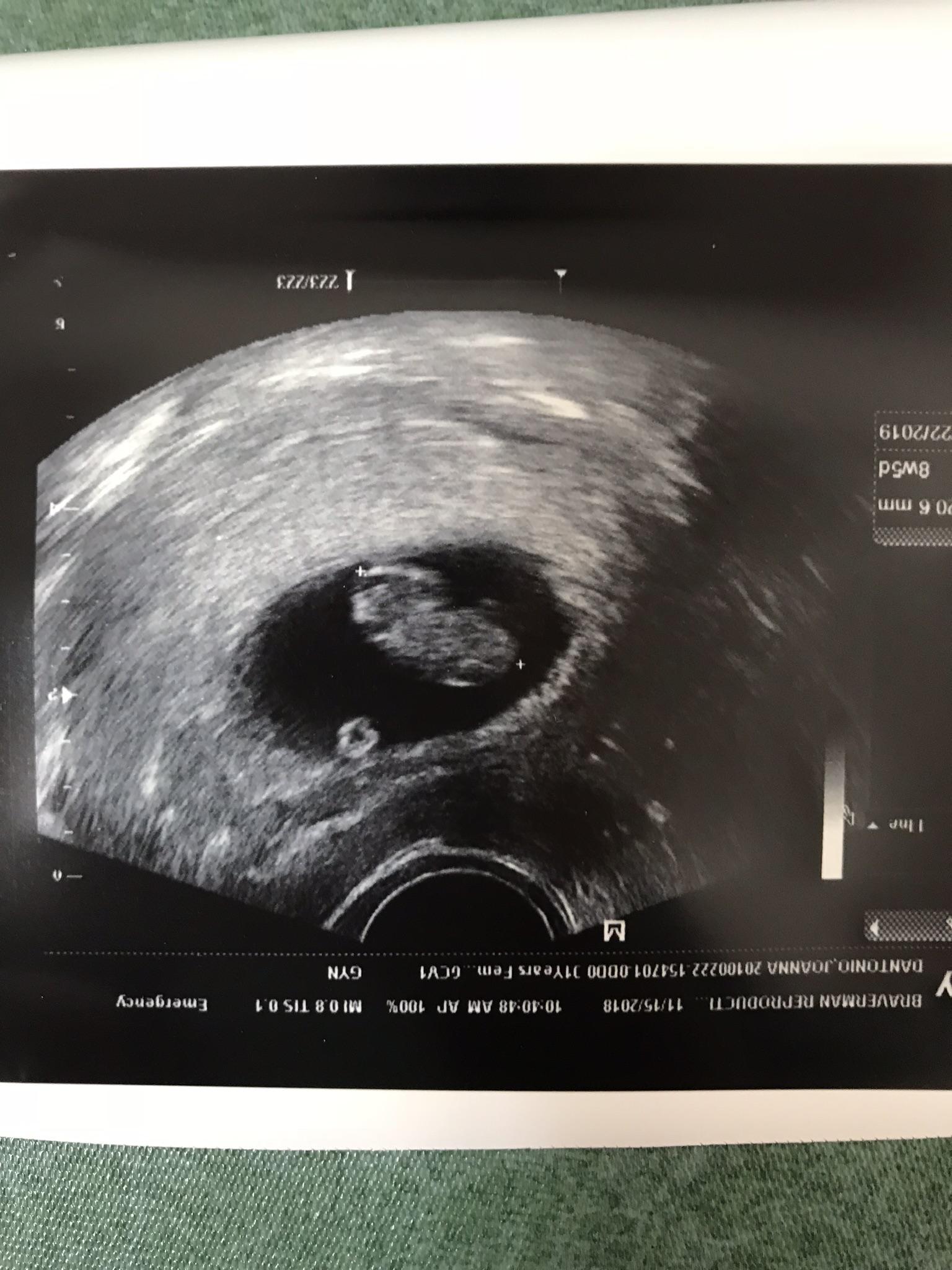 Our (at the time-mid November…